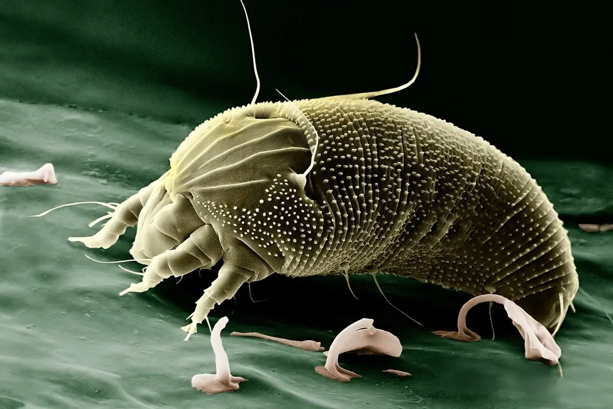 Cresce la paura della scabbia, sempre più persone scelgono l’isolamento domestico Immagine selezionata