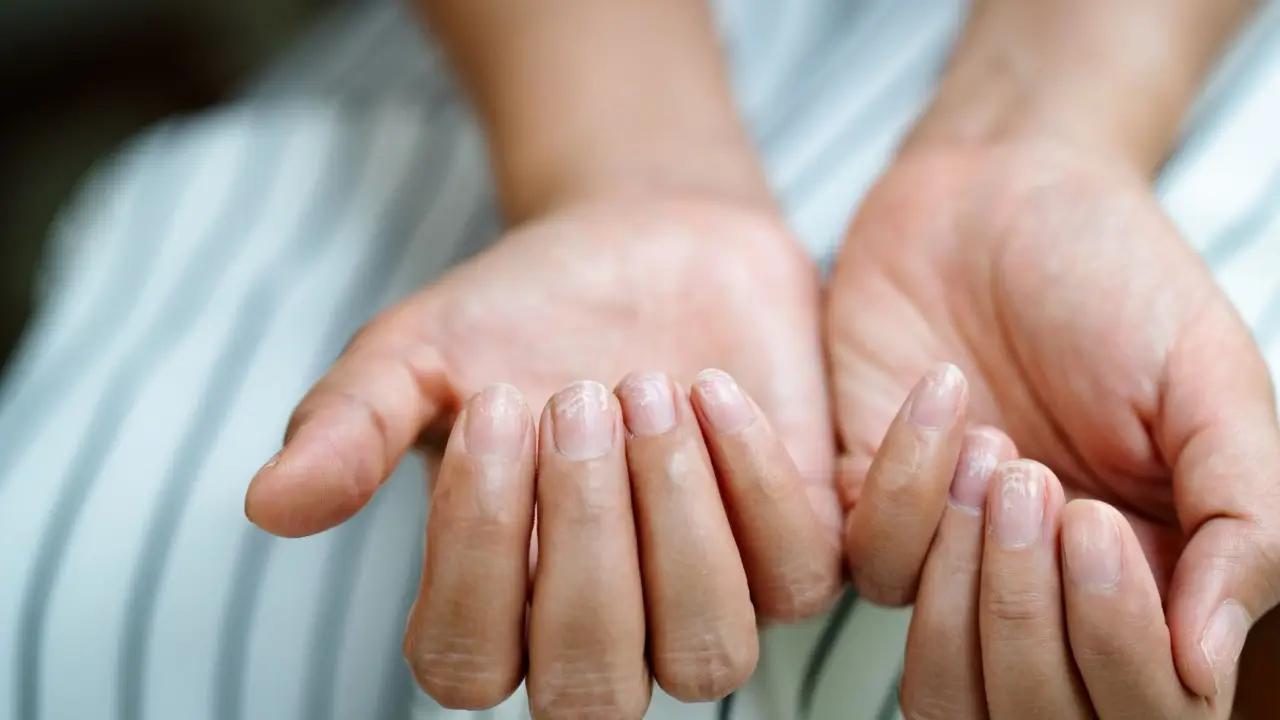 Cresce la paura della scabbia, sempre più persone scelgono l’isolamento domestico Immagine selezionata