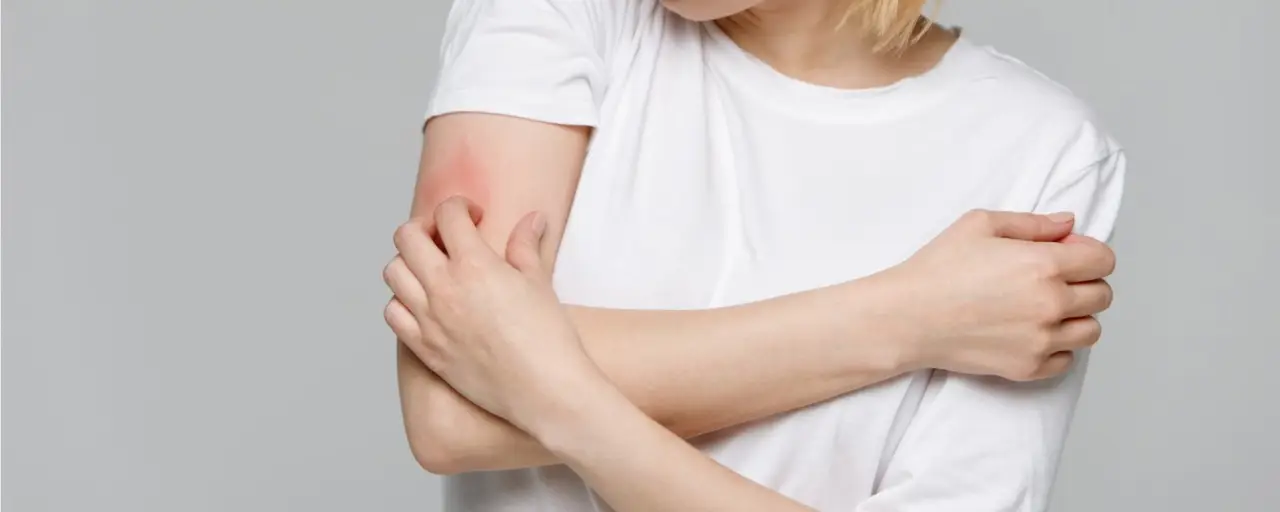 Cresce la paura della scabbia, sempre più persone scelgono l’isolamento domestico Immagine selezionata